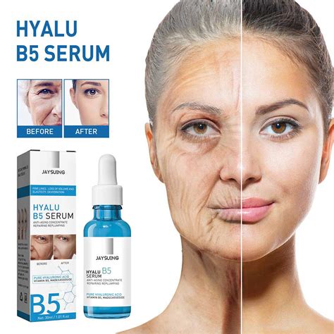 hyalu b5 serum jaysuing review.